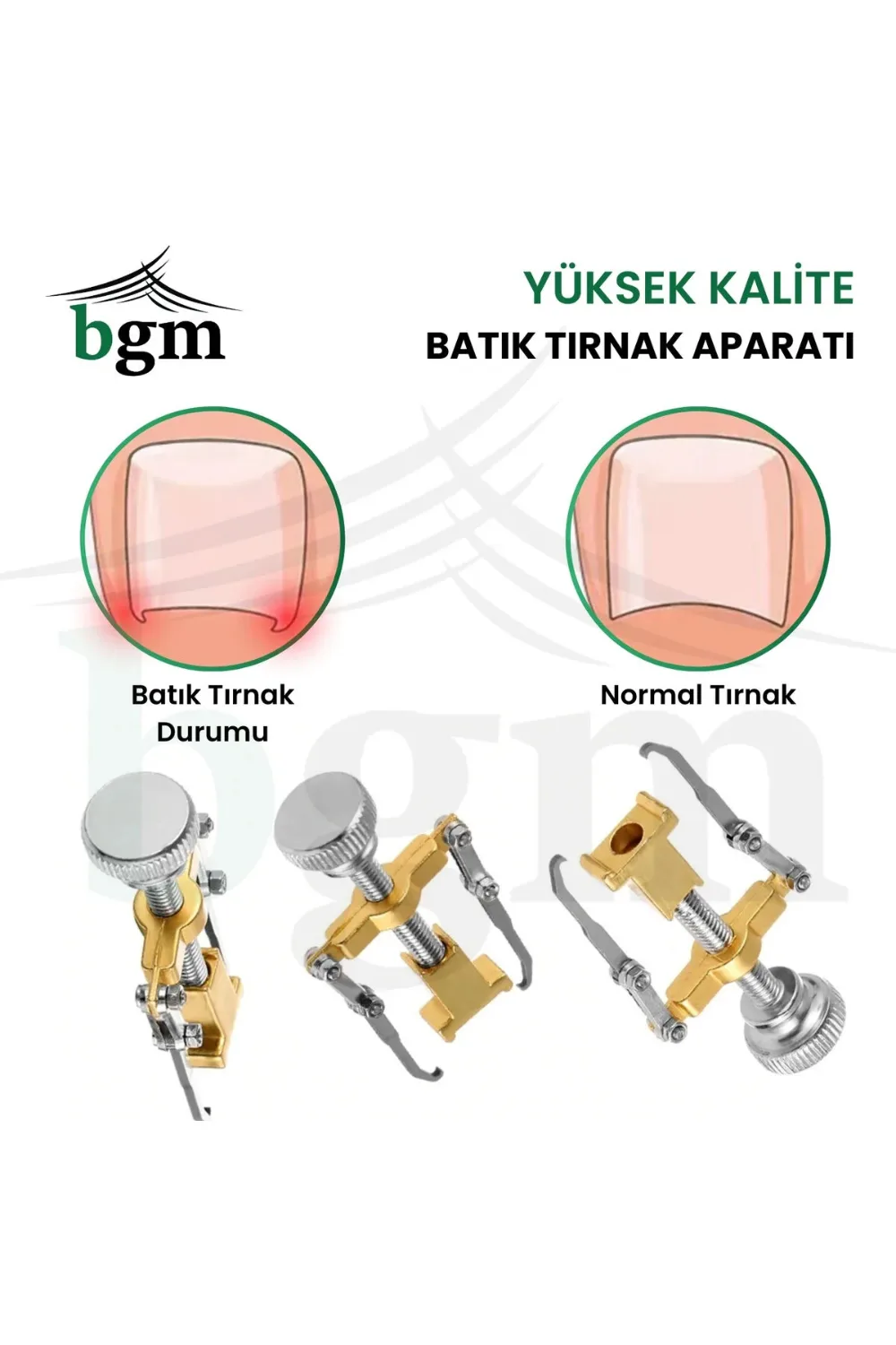 BGM Batık Tırnak Düzeltme Aparatı