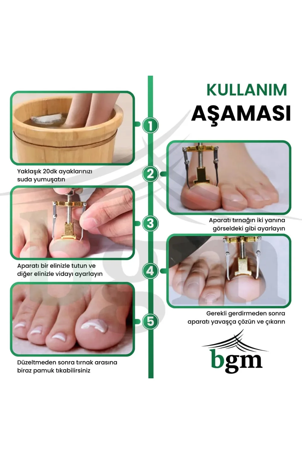 BGM Batık Tırnak Düzeltme Aparatı
