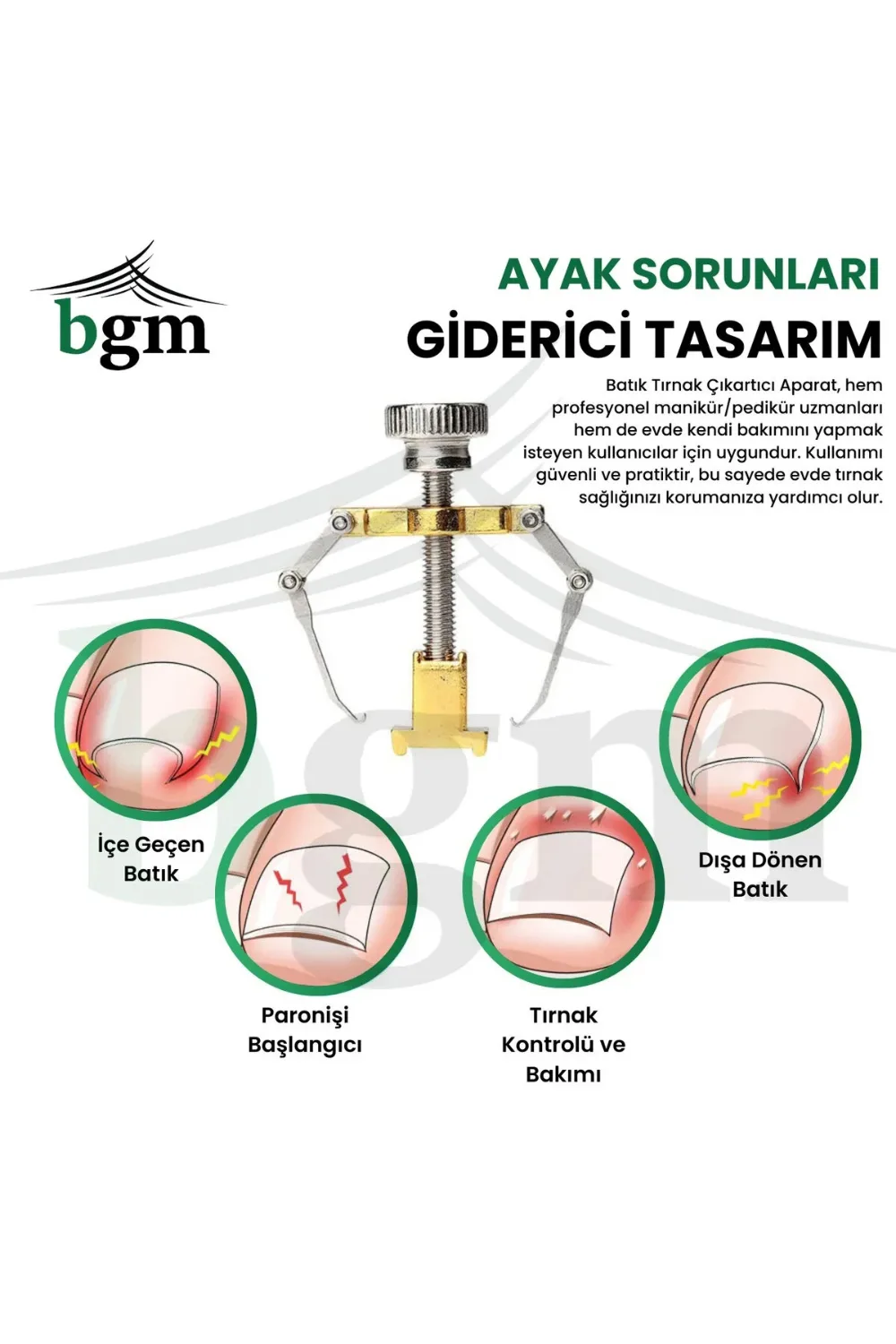 BGM Batık Tırnak Düzeltme Aparatı